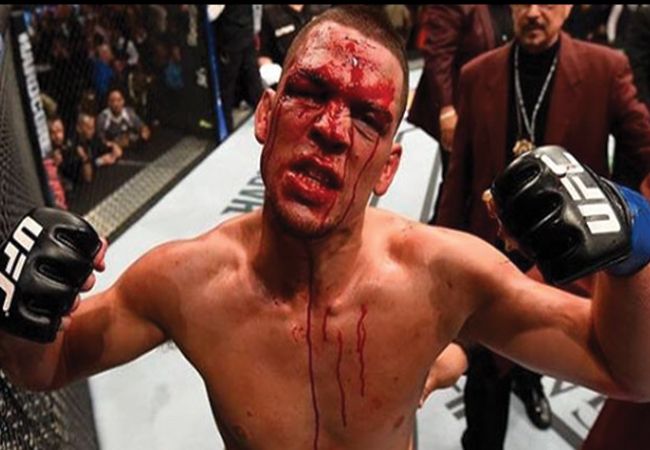 Nate Diaz overweegt gerechtelijke stappen na fake nieuws