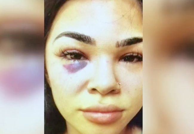 Straf voor man UFC-vechter Rachel Ostovich na mishandeling