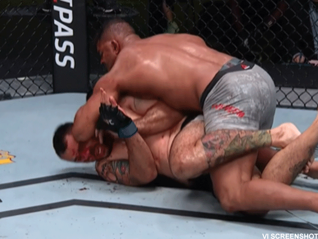 GEBROKEN BOTTEN: Alistair Overeem sloopte tegenstander Sakai