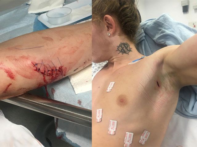 ? | NEERGESTOKEN MMA-VECHTER: 'Het had anders kunnen aflopen'