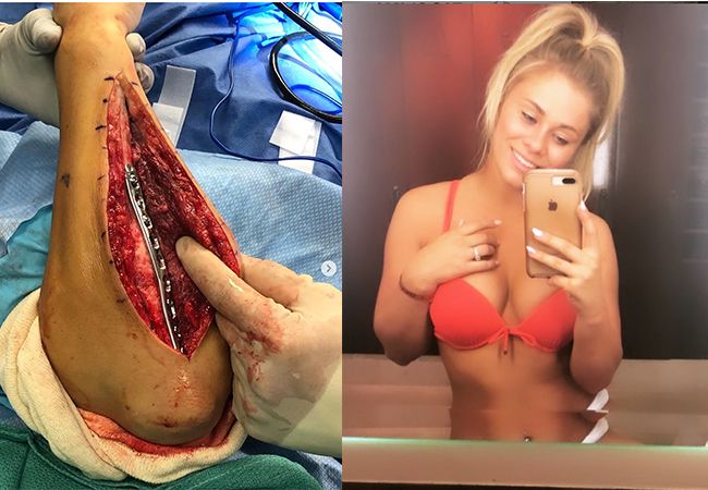 Bizarre foto: UFC-vechter Paige vanZant schokt fans