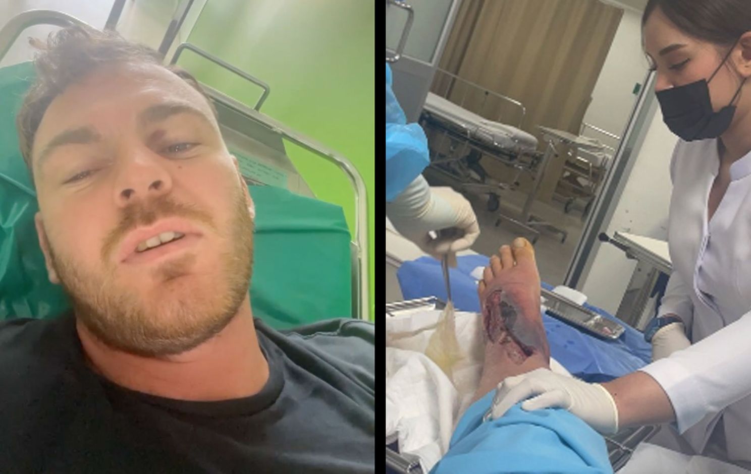 'Been amputatie!' Zware infectie MMA-vechter opgelopen bij training kan jou ook overkomen