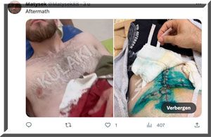 🎥 Brute steekpartij! Kooivechter Dzhahar Mazhidov slachtoffer 'redde zelf man'