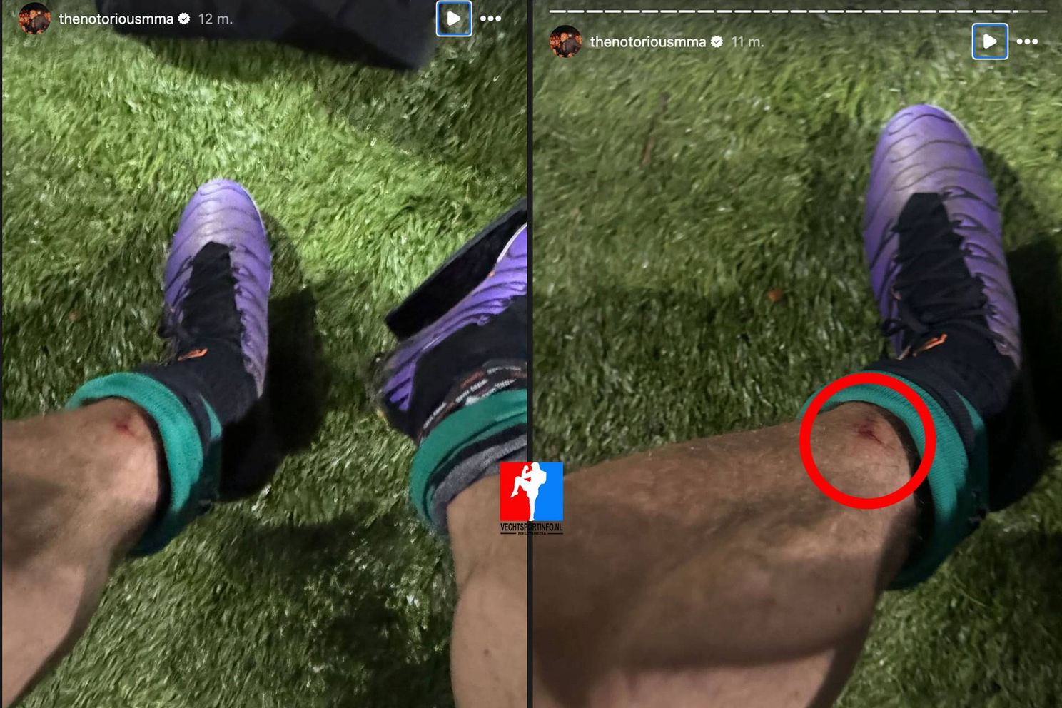 UFC ster McGregor flink gewond tijdens fanatiek potje voetbal - comeback in gevaar?