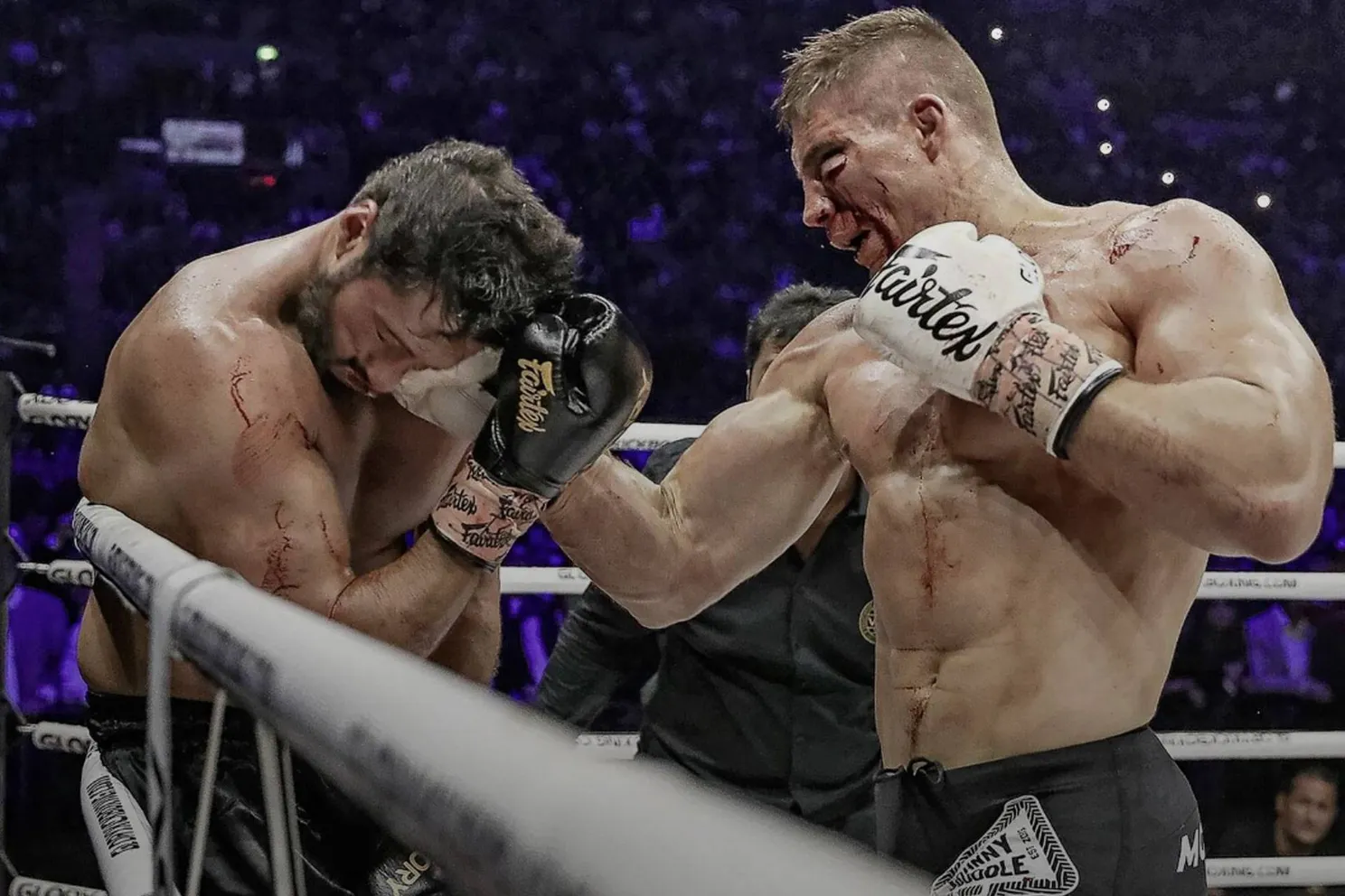 Meest voorkomende kickboksblessures: dit moet elke vechter weten