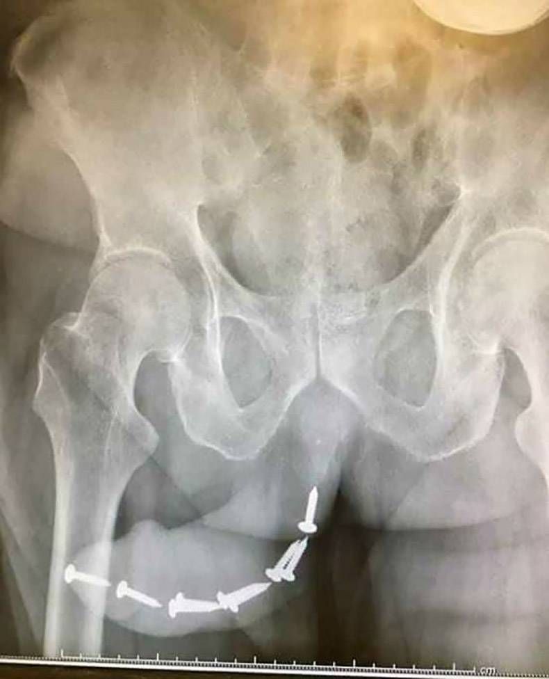 Gewoon een verzameling hilarische foto's #895