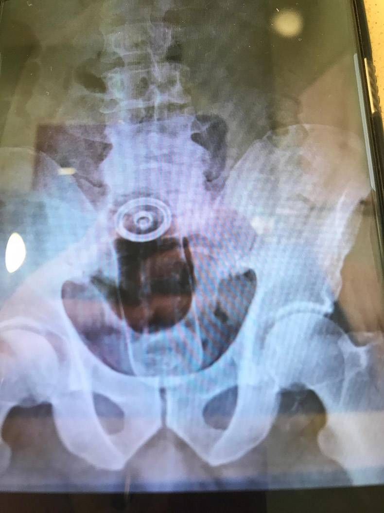 Gewoon een verzameling hilarische foto's #823