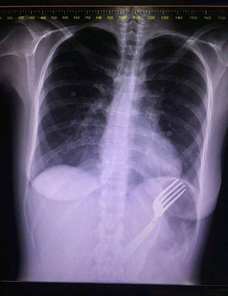 Gewoon een verzameling hilarische foto's #806