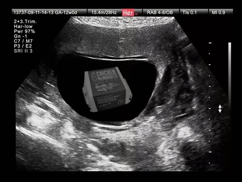 Gewoon een verzameling hilarische foto's #823