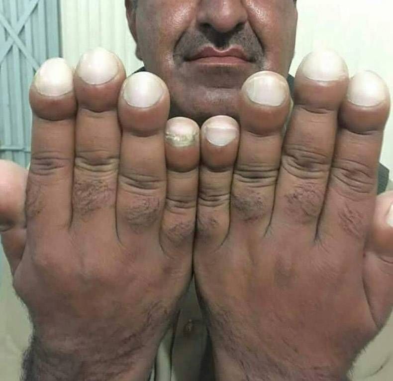 Gewoon een verzameling hilarische foto's #1088