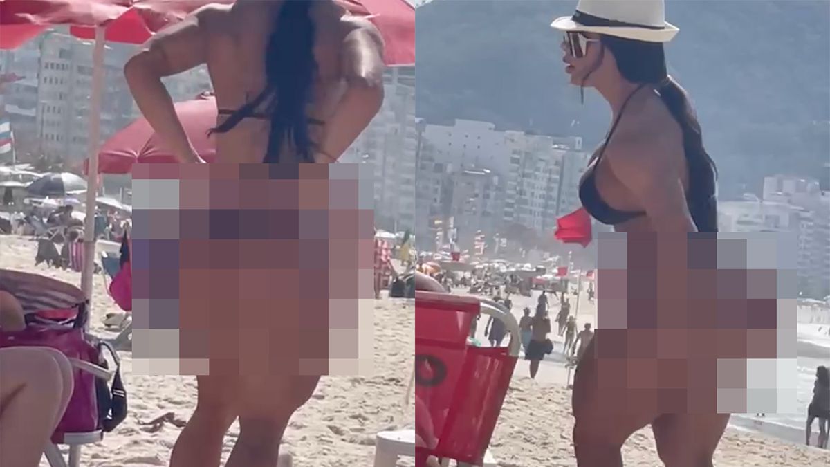 Je kunt natuurlijk ook overdrijven als je je achterwerk bij een dokter koopt