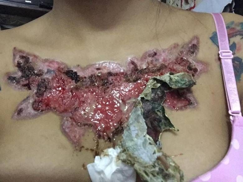 21-jarige Thaise dacht haar tattoo even te verwijderen