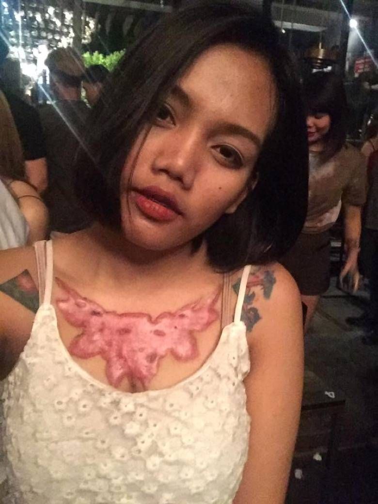 21-jarige Thaise dacht haar tattoo even te verwijderen