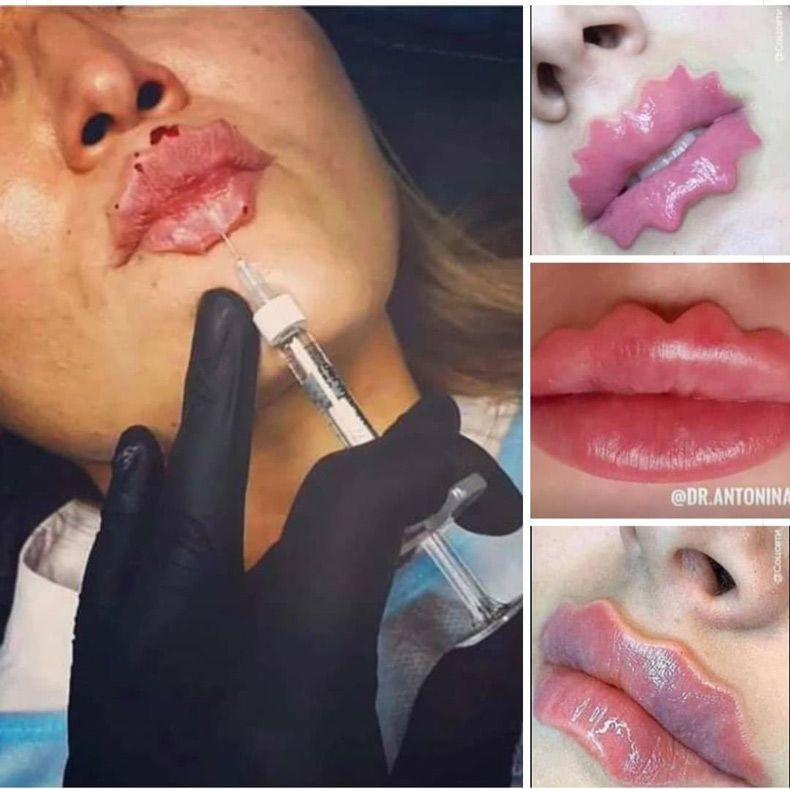 Gewoon een verzameling hilarische foto's #1538