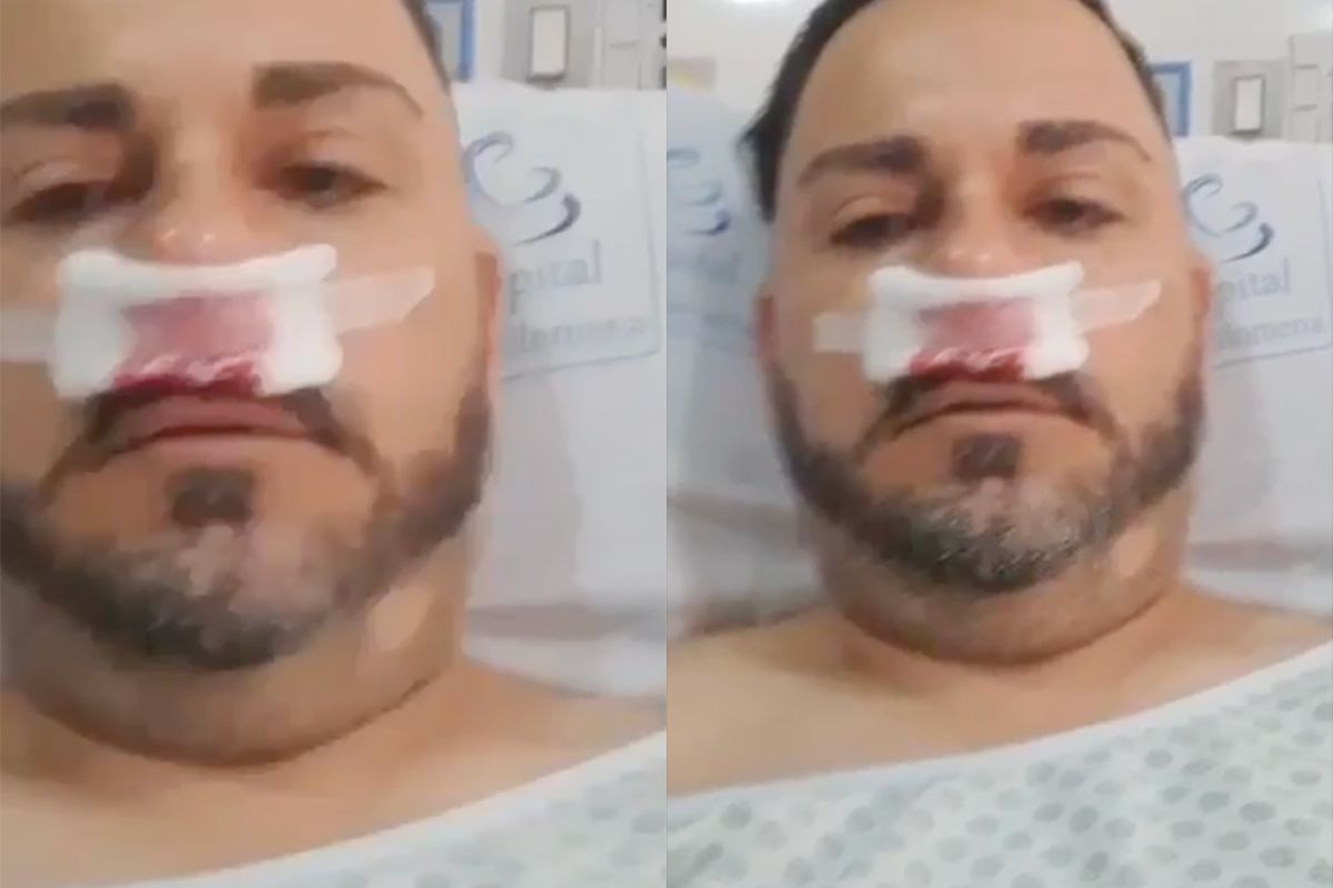 Zo, leg jij eens uit hoe je aan die aparte blessure aan je gezicht komt?