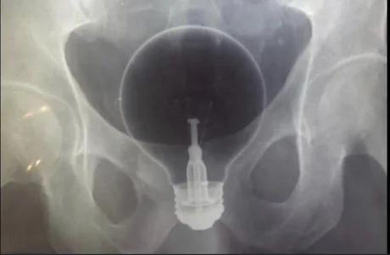 Gewoon een verzameling hilarische foto's #1709