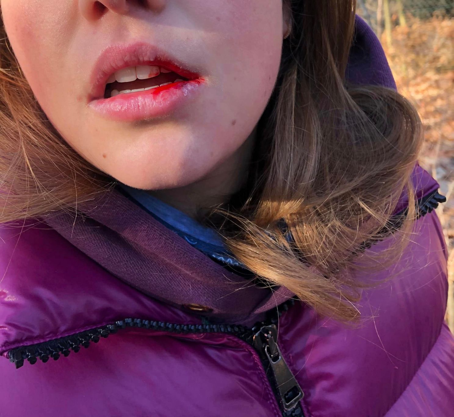 Mountainbiker geeft meisje een kaakslag op bospad in Waalre