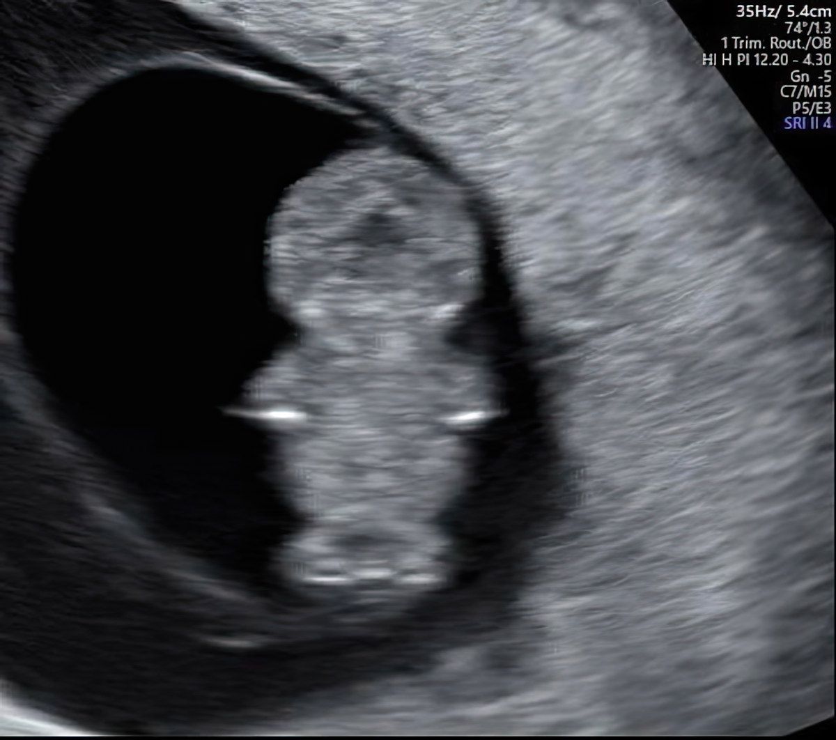 Gewoon een verzameling hilarische foto's #1839