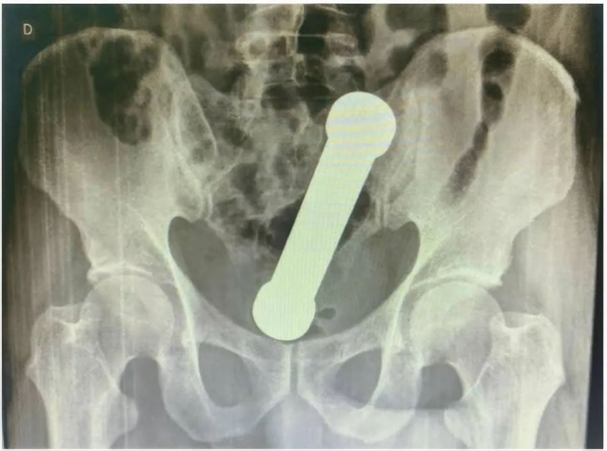 picture_vk_dumbell_brasil_01