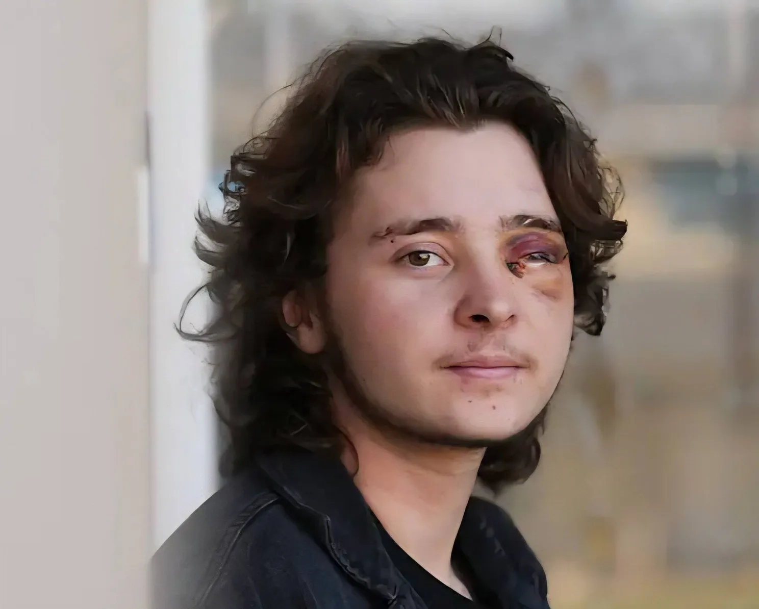 21-jarige betoger raakt blind na ‘non-lethal’-schot in gezicht bij protest in Santa Ana