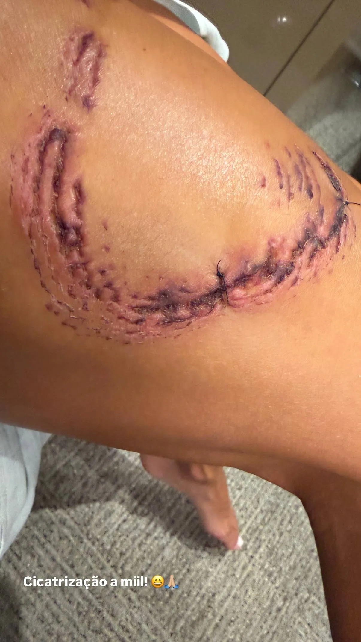 Duikster krijgt ‘beijinho’ van verpleegsterhaai in Brazilië