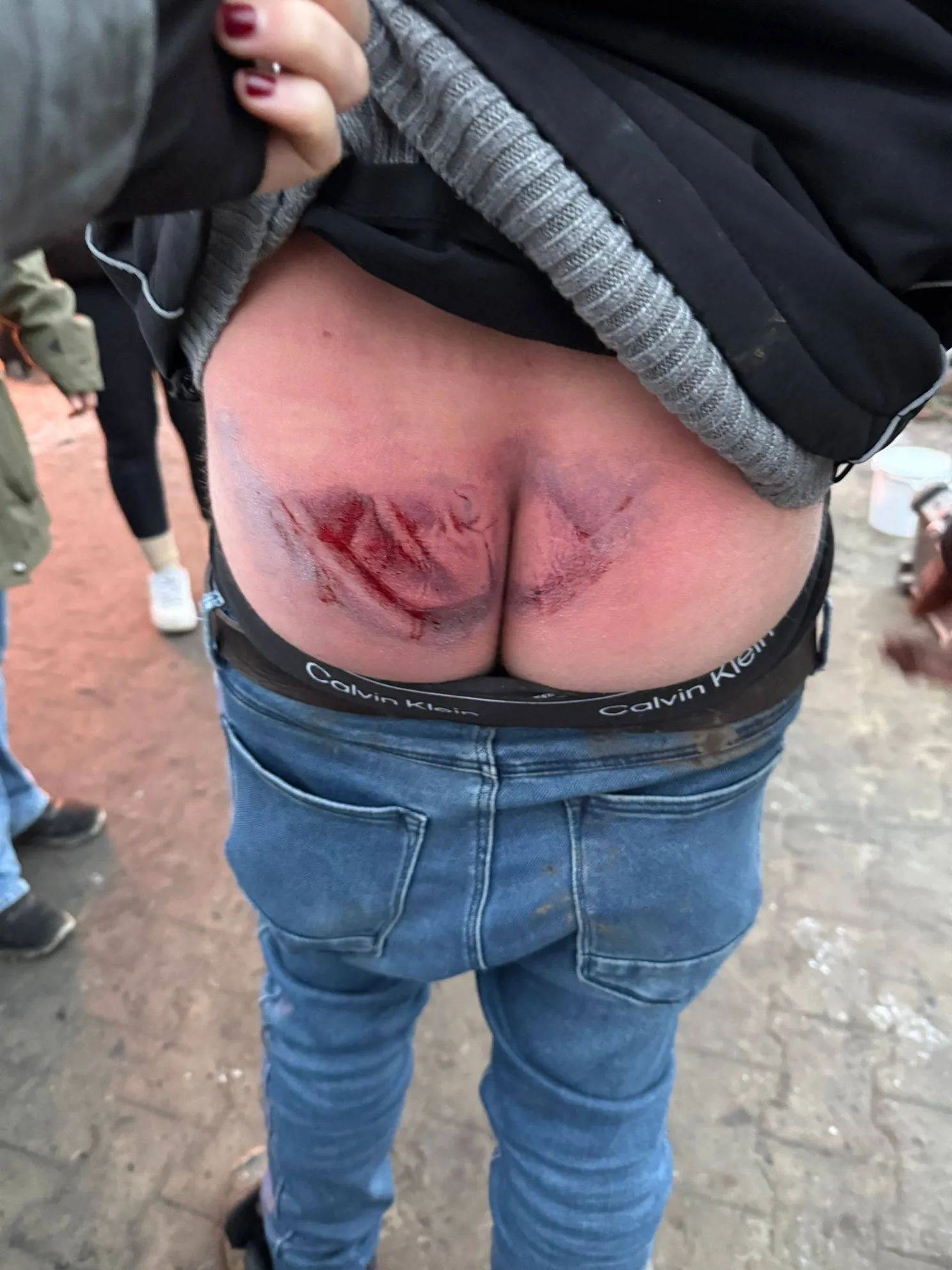 picture_vk_2026_kontje_kick_pijn