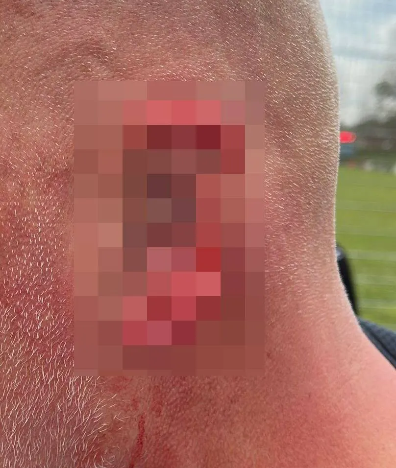 picture_vk_oor_afgebeten