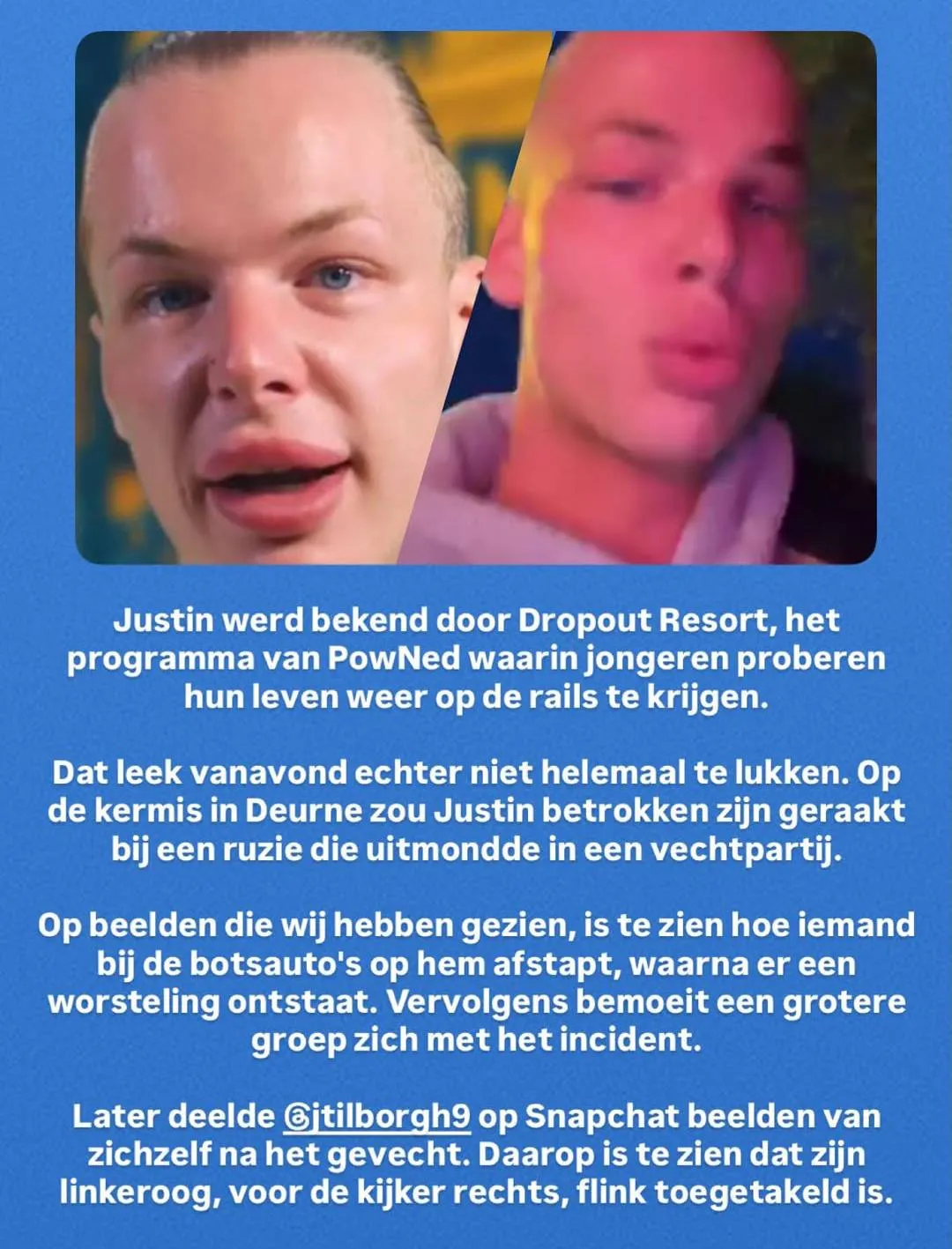 picture_vk_toegetakeld_oog