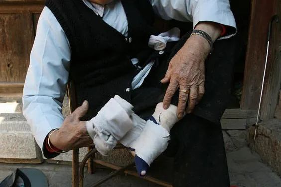 Schokkende foto's tonen de gruwel van het oude Chinese voetbinden