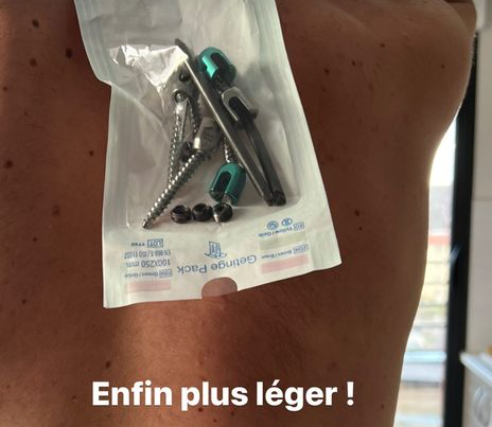 Sementara itu di peloton |  Cavagna kehilangan dua pin di punggungnya: sedikit lebih ringan