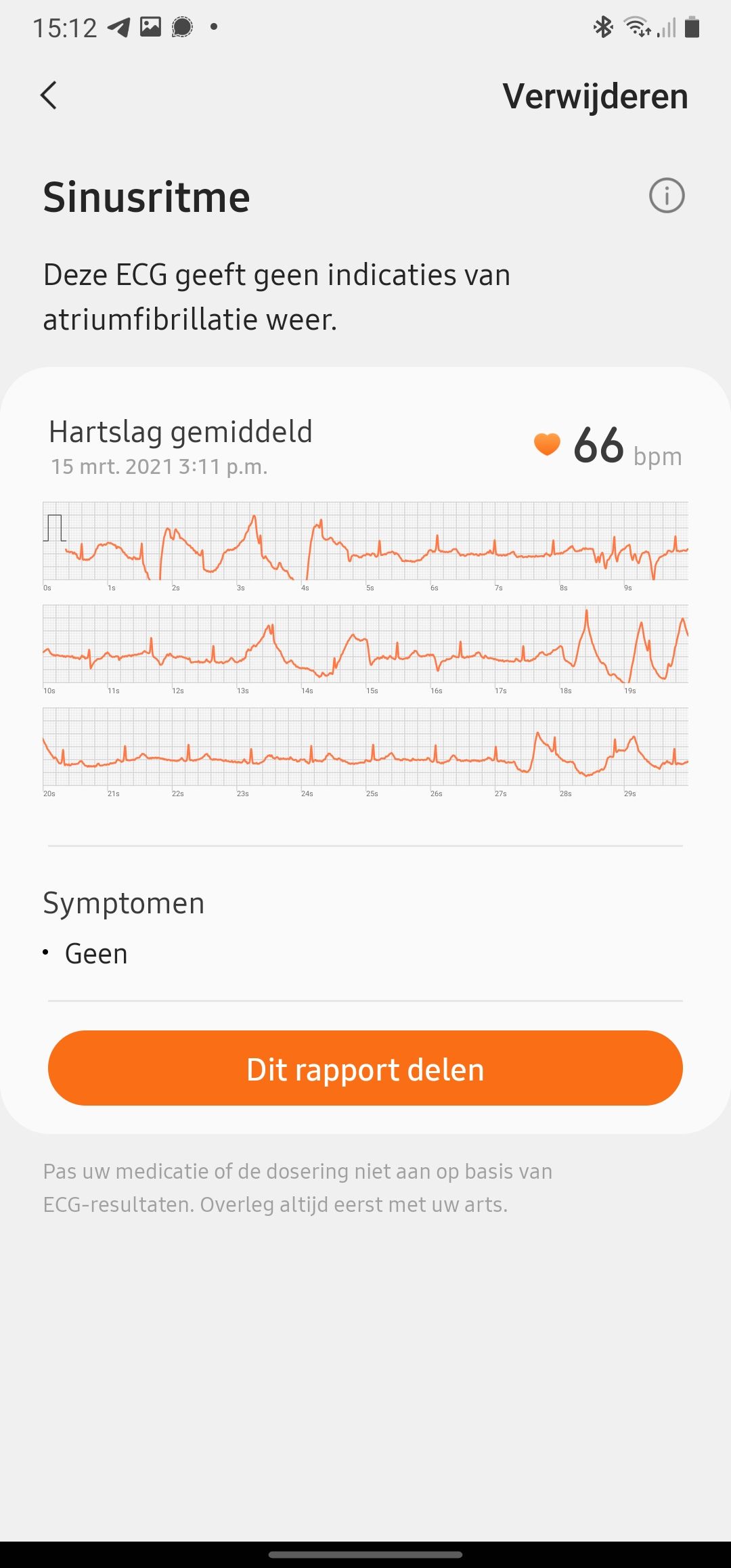 Samsung Galaxy Watch 3 meet ECG en bloeddruk zo stel je de