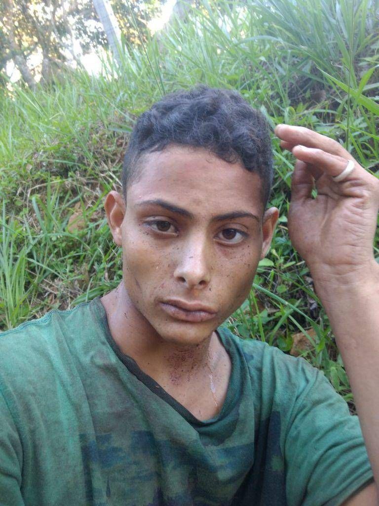 WTF: Poging tot onthoofding van slachtoffer overval in Brazilië
