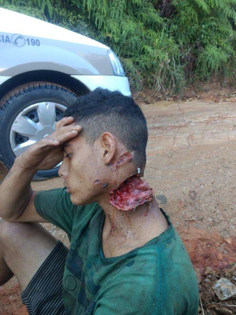 WTF: Poging tot onthoofding van slachtoffer overval in Brazilië