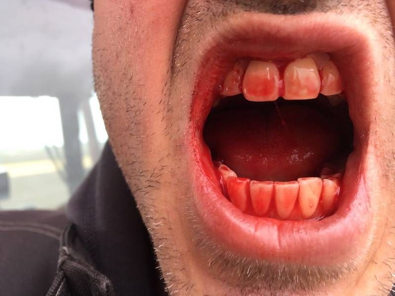 Gewoon een verzameling hilarische foto’s #799