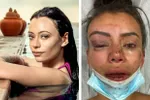 Temptation-Yasmine onthult details over zware mishandeling: "Hij sloeg me meteen knock-out"