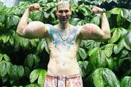 Russische Popeye beklaagt olie-injectie in biceps en geeft toe dat schade niet hersteld kan worden