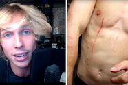 Inbraak YouTuber Acid op TML wordt compleet fiasco: vriendin achtergelaten, gehavend en opgepakt