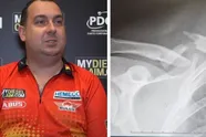 Darter Kim Huybrechts breekt sleutelbeen bij vechtpartij na bekerfinale Union-Antwerp: "Een ramp!"