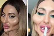 Model met 's werelds grootste wangen deelt foto van hoe ze eruitzag vóór plastische chirurgie