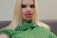 Jonge vrouw heeft 27 procedures om de grootste lippen ter wereld te krijgen, dit is hoe ze er vroeger uit zag