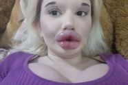 Andrea (23) wil niet meer stoppen met lipfillers: "Ik vind me nu veel beter met grote lippen"