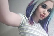 Vrouw (24) met grootste lippen ter wereld: “Nu wil ik een gezichtsverlenging”