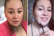 Vrouw (36) laat baard groeien: “Eindelijk stoort het me niet meer”