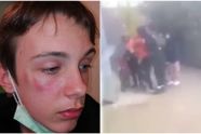 Kylian (14) zwaar toegetakeld door groepje jongeren in Keerbergen: "Hier zijn geen woorden voor"