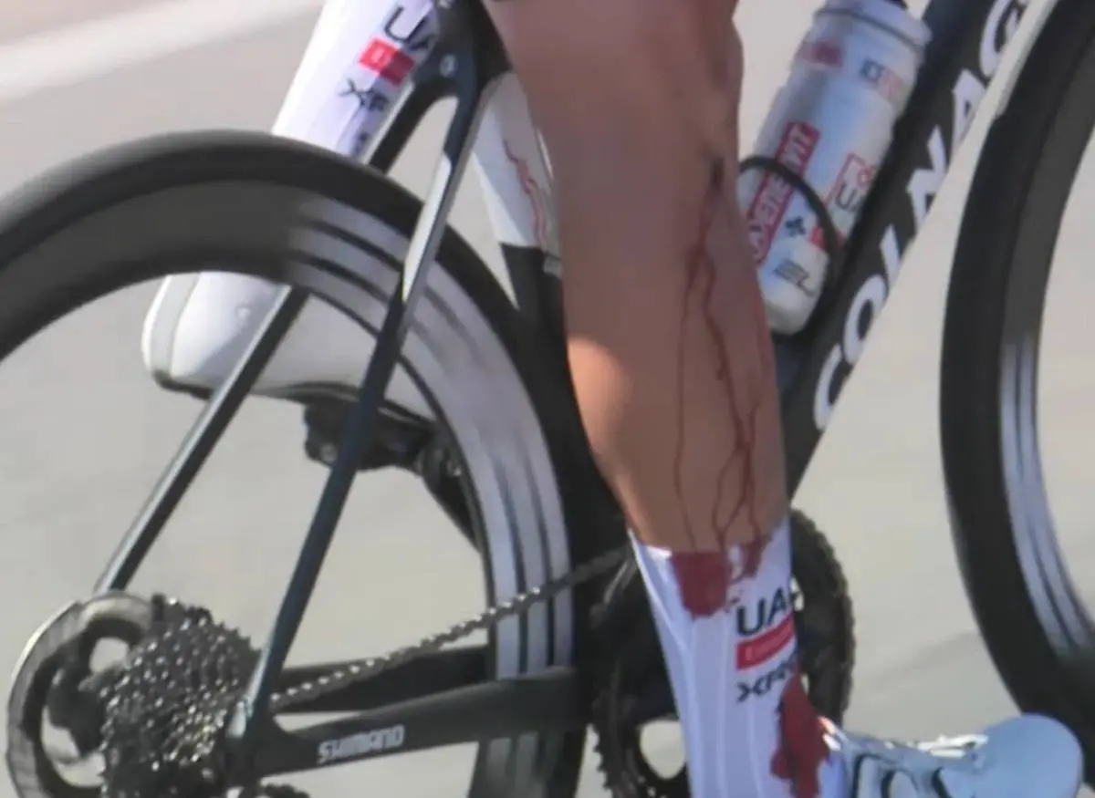 Relatório médico e abandonos - Tour Down Under 2025 4ª etapa: Jay Vine novamente envolvido numa queda