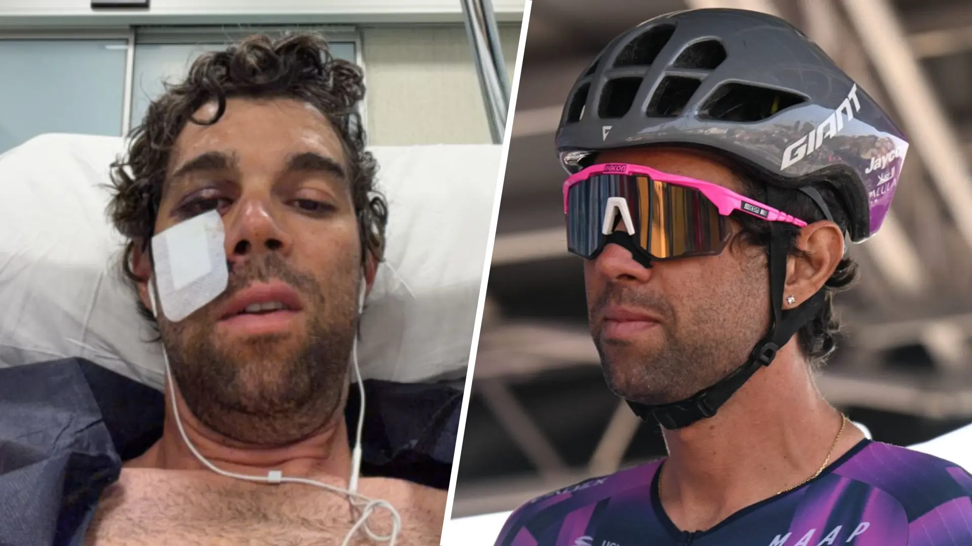 “It has been a huge process” – Michael Matthews reveals full extent of horror crash after multiple surgeries and brutal six-week recovery