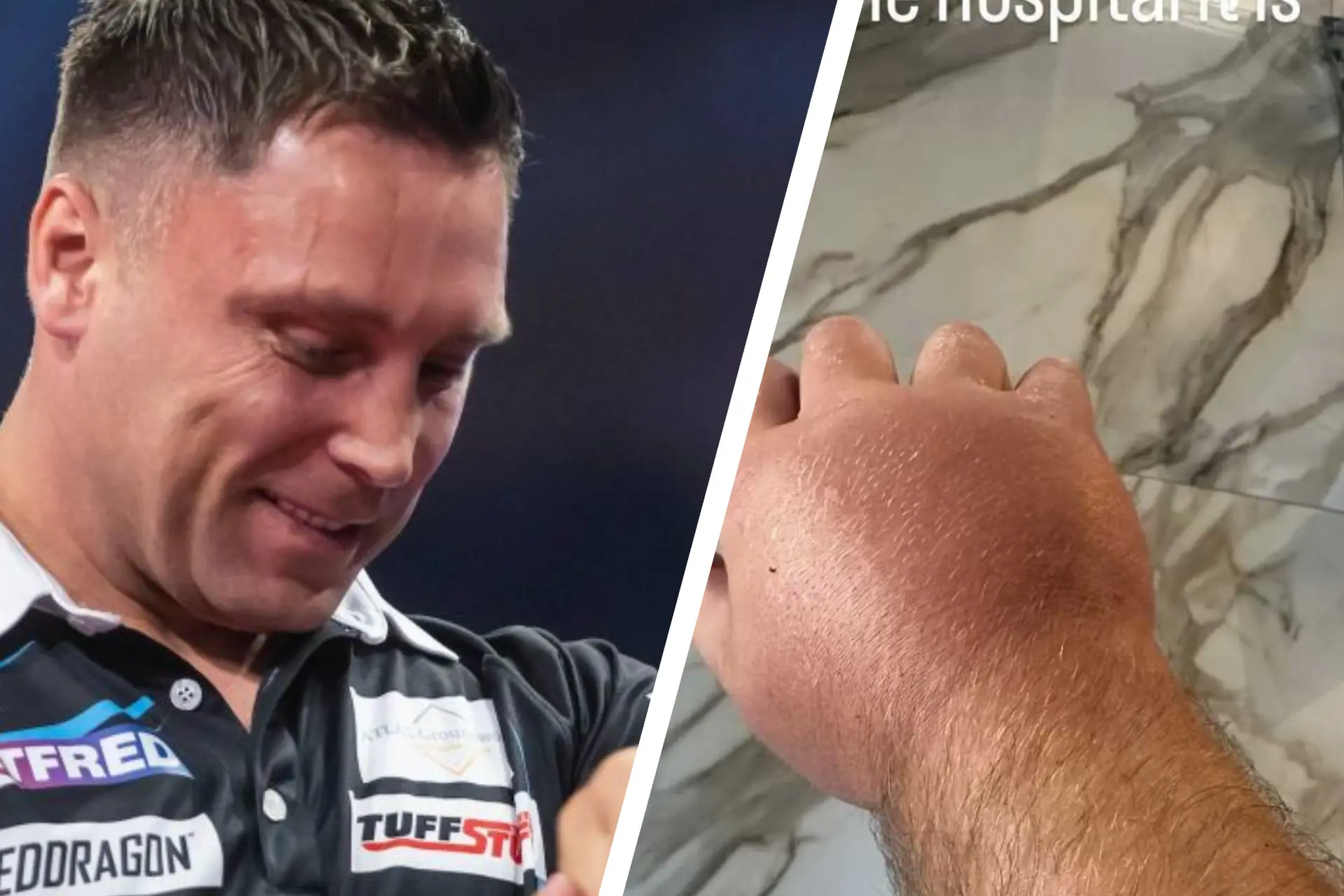 "Net wat ik niet wilde, terug naar het ziekenhuis" - Gerwyn Price mist Players Championship 24 door opgezwollen hand
