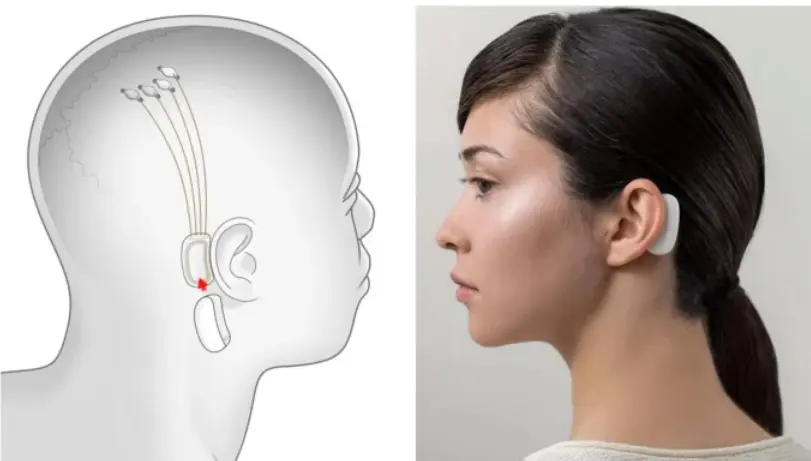 fhm neuralink 01