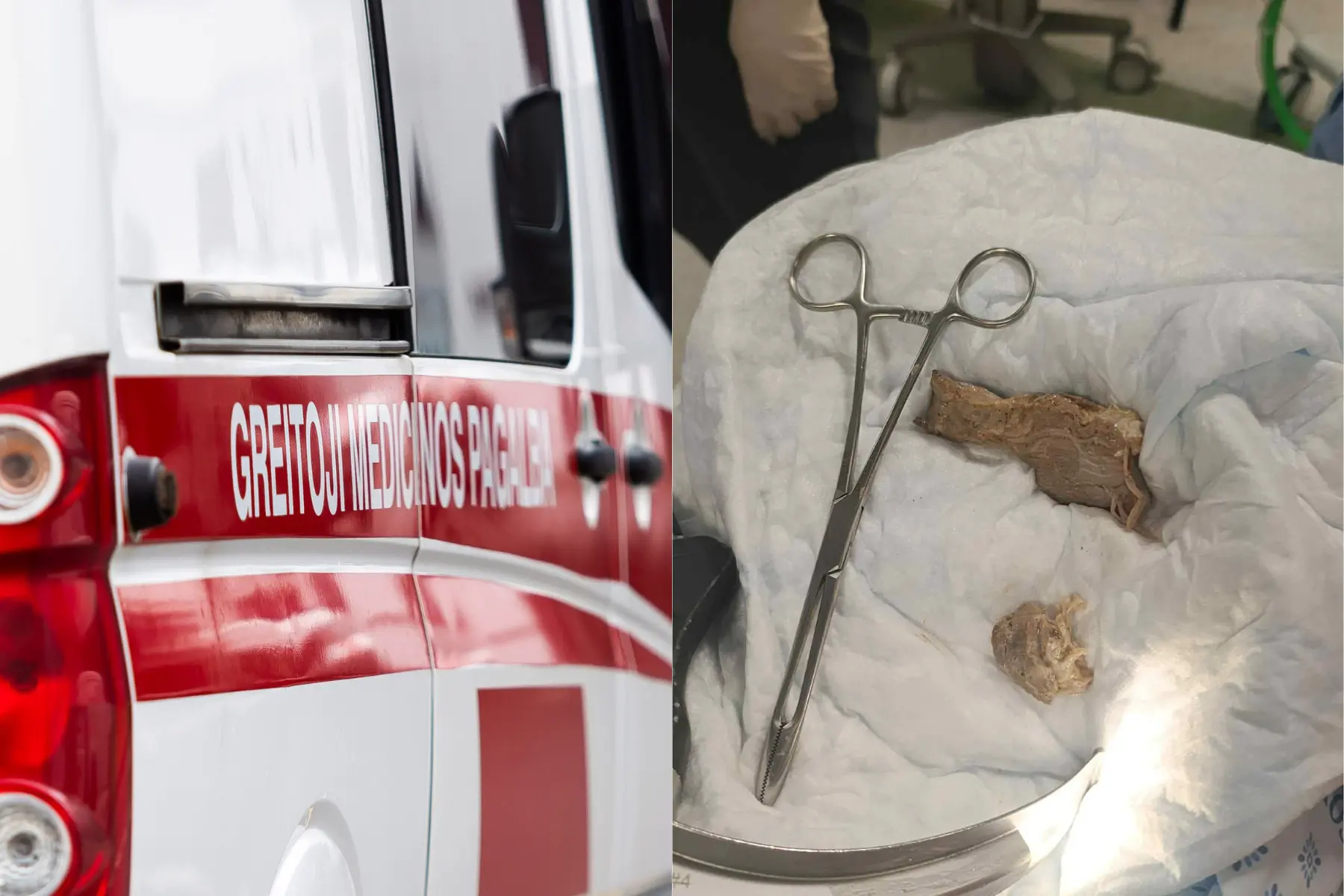Iš kvėpavimo takų pašalintas kepsnio gabalas / Kauno klinikų skubios pagalbos skyriaus / D. Labučio / ELTA nuotr.