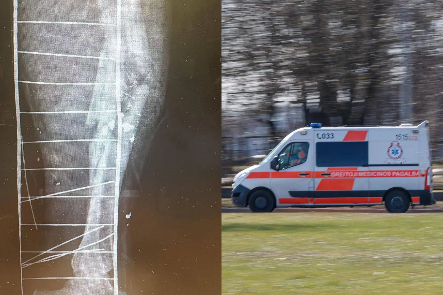 Neeilinis atvejis Kauno klinikose: vyrui gyvybę galėjo išgelbėti virvė